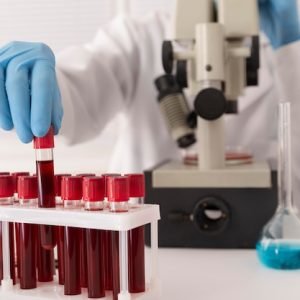 coronavirus-blood-samples-arrangement-lab_23-2149107259 Best Fertility Hospital in Patna