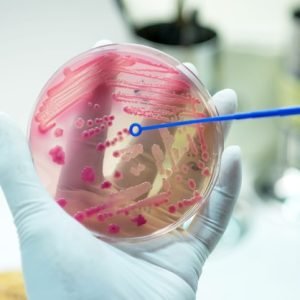 media-plate-hand-medical-technicians-working-bacterial-culture-pathogens_38583-22 DR Smriti Sparsh